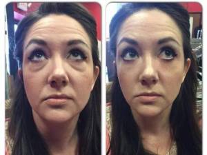 Jeunesse-Instantly-Agelesss-Before-After1