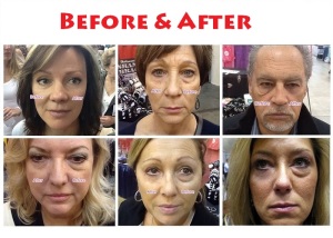 Jeunesse-Instantly-Agelesss-Before-After3